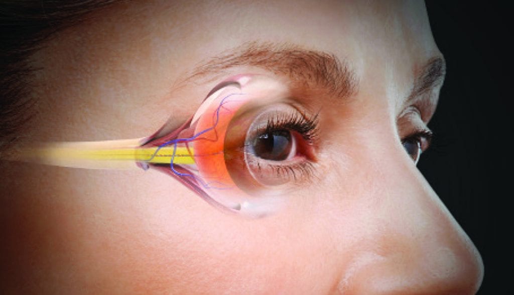 Aging eyes