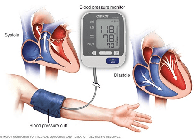 Hypertension – Tackling the Silent Killer