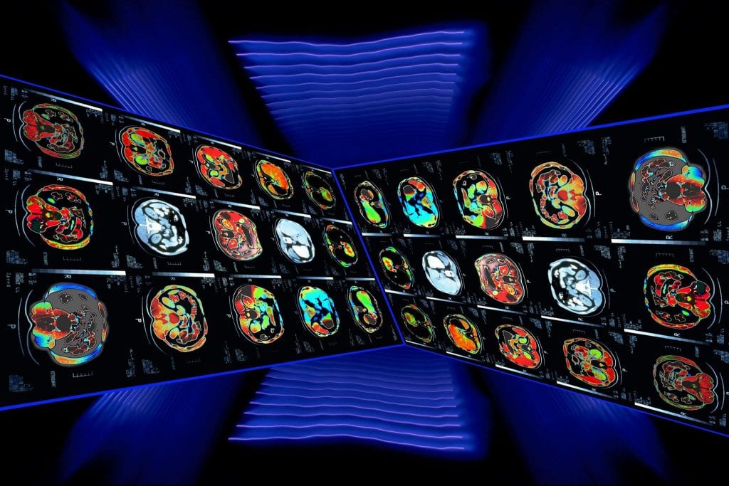 ct scan