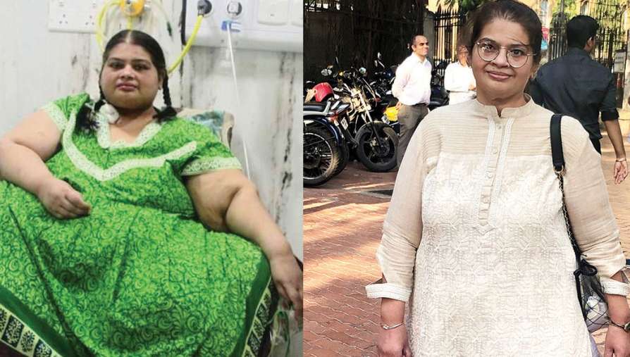 SHOCKING : Reduced from 300kg to 86 Kg [Weight Loss Surgery]