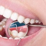How to treat gum disease properly