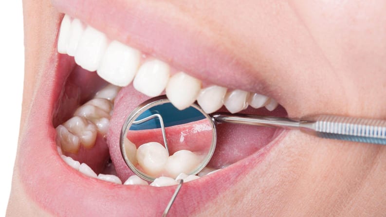 How to treat gum disease properly