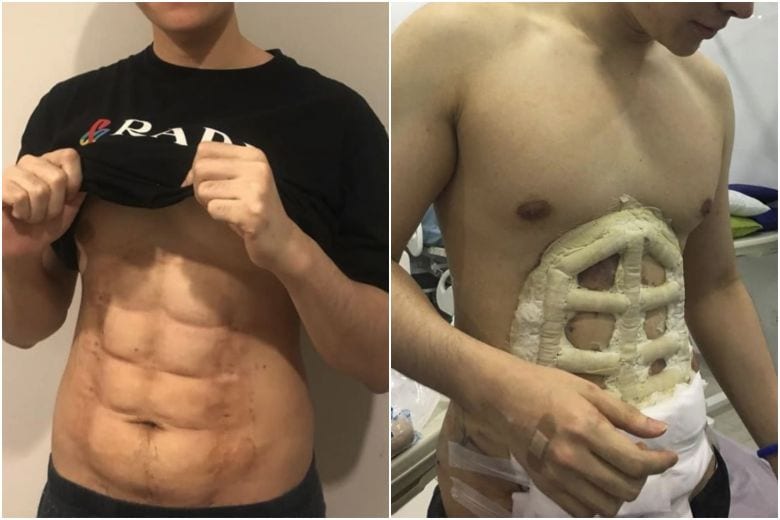 instant six pack abs