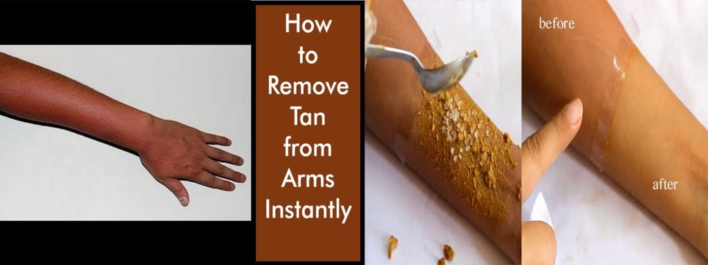 Remove Tan from Arms