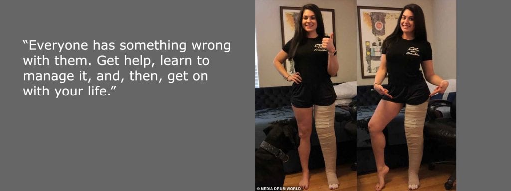 Women Swollen Leg
