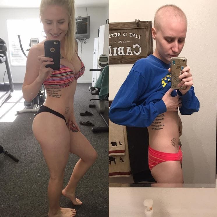Cheyann Shaw cancer
