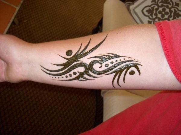 Tattoo removal