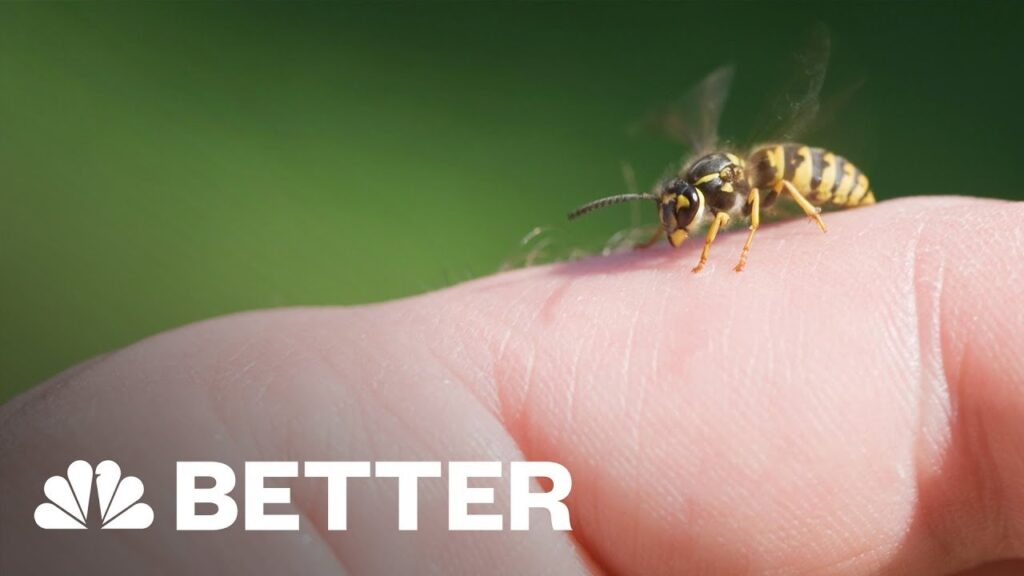 5 Home Remedies for Bee Stings 1