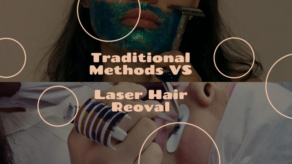 laser hair removal