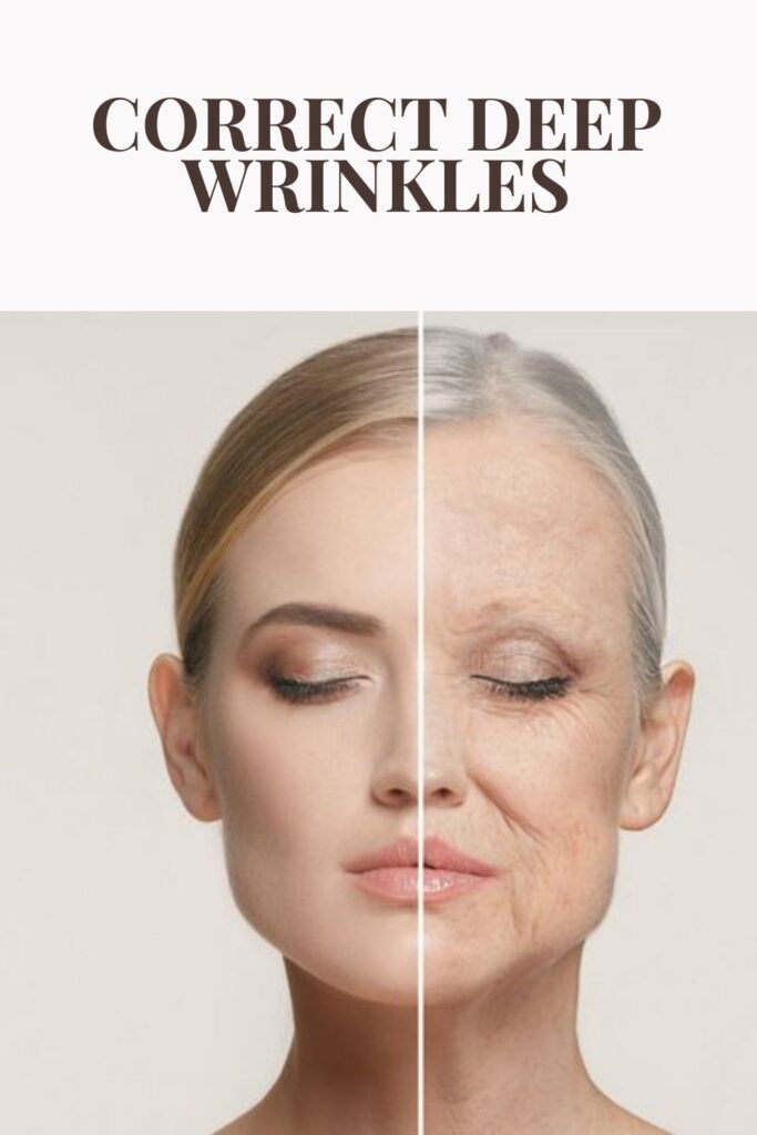 Before and after effects of wrinkles removals - Removal of intense wrinkles
