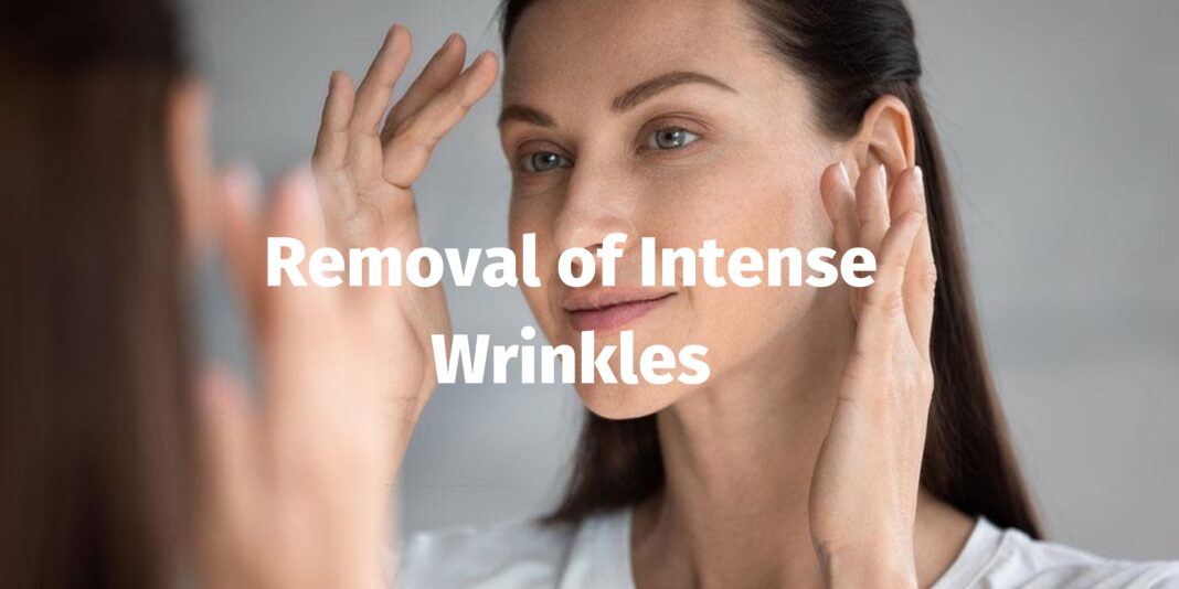Removal of intense wrinkles