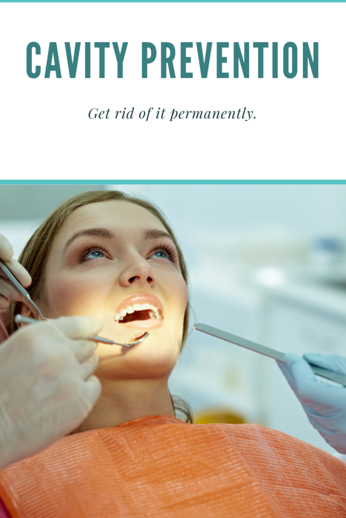 Cavity Prevention - get rid permanently