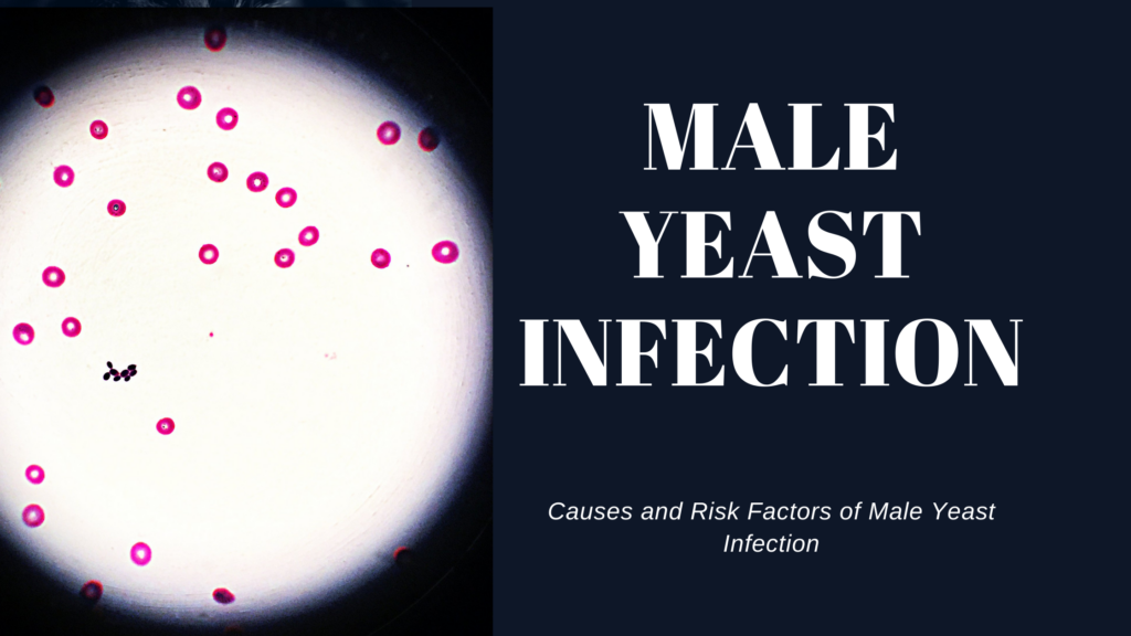 graphic of bacteria trying to represent male yeast infection