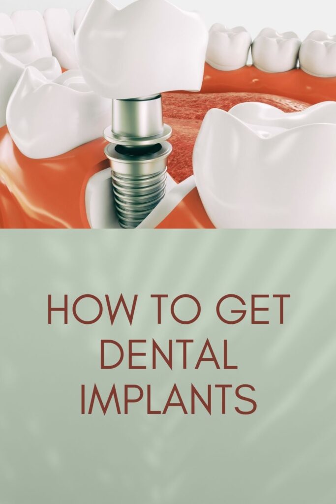 dental implant procedure - dental implant
