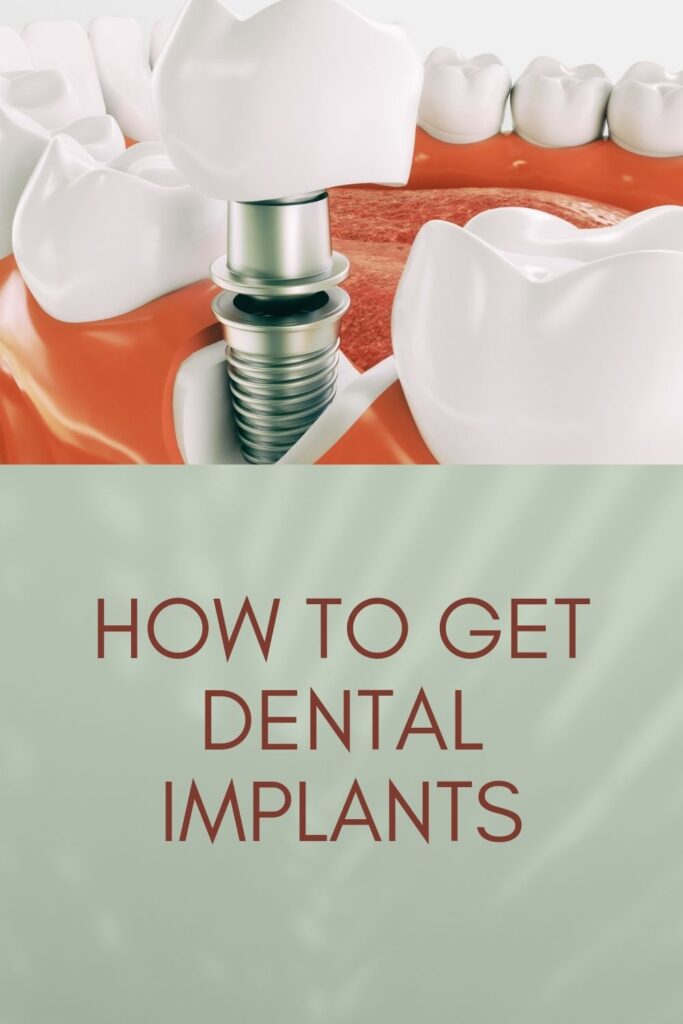 dental implant procedure dental implant procedure - dental implant