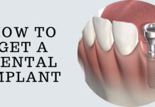 how to get Dental Implant