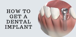 how to get Dental Implant