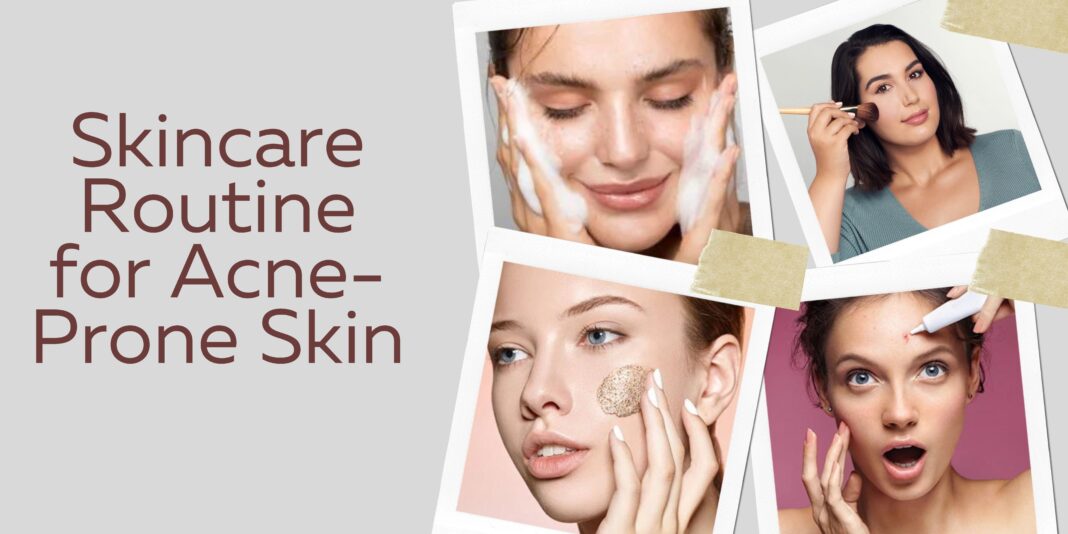 Skincare Routine for Acne-Prone Skin