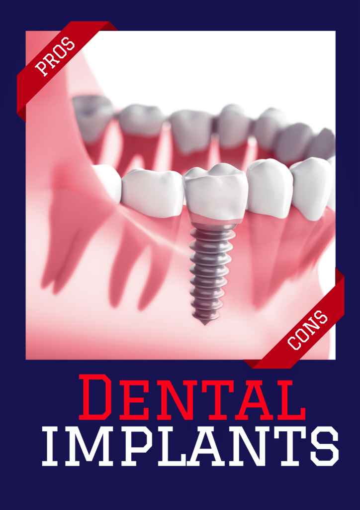 Dental implants pros -cons | Poster having dental implanting teeth photo