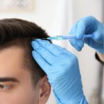 Hair Loss Treatment For Men In Canada
