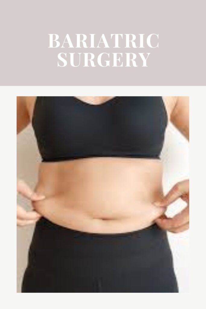 A women is showing her belly fat - Weight Loss Surgery