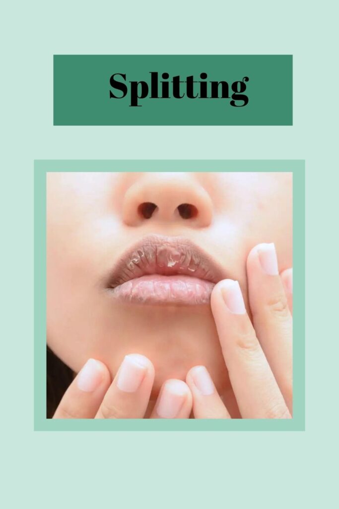 A girl is showing her splitting lips A girl is showing her splitting lips - lip care tips