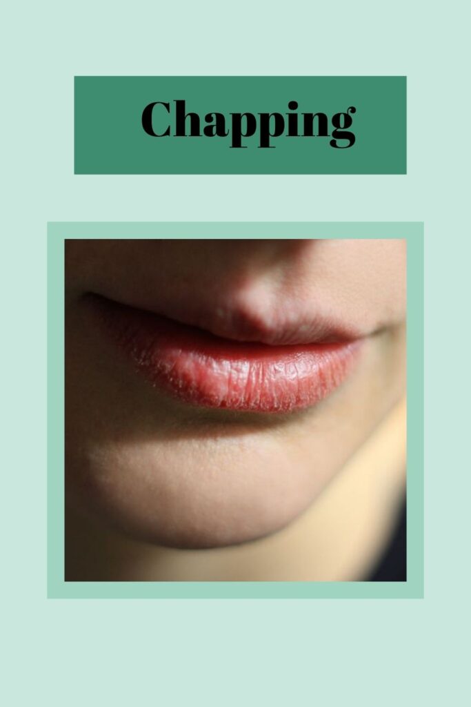 Some girl is showing her chapped lips Some girl is showing her chapped lips - Lip care