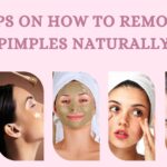 Tips on How to Remove Pimples Naturally