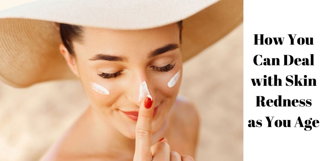 How You Can Deal with Skin Redness as You Age