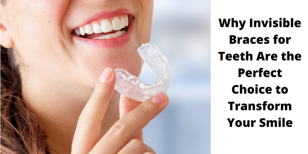 Why Invisible Braces for Teeth Are the Perfect Choice to Transform Your Smile