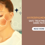 hyperpigmentation safe treatment for skin