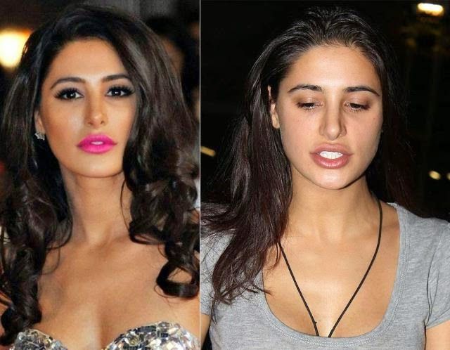 Nargis Fakhri before and after pics of cosmetic surgery - surgery of bollywood actress