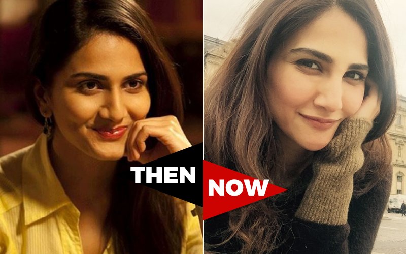 Vaani Kapoor before and after pics of cosmetic surgery - cosmetic surgery actress