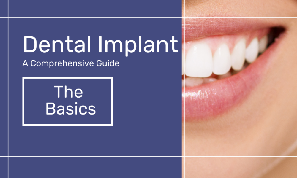 Dental Implant - A Comprehensive Guide - Poster of half Smily face Teeth