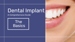 Dental Implant - A Comprehensive Guide - Poster of half Smily face Teeth