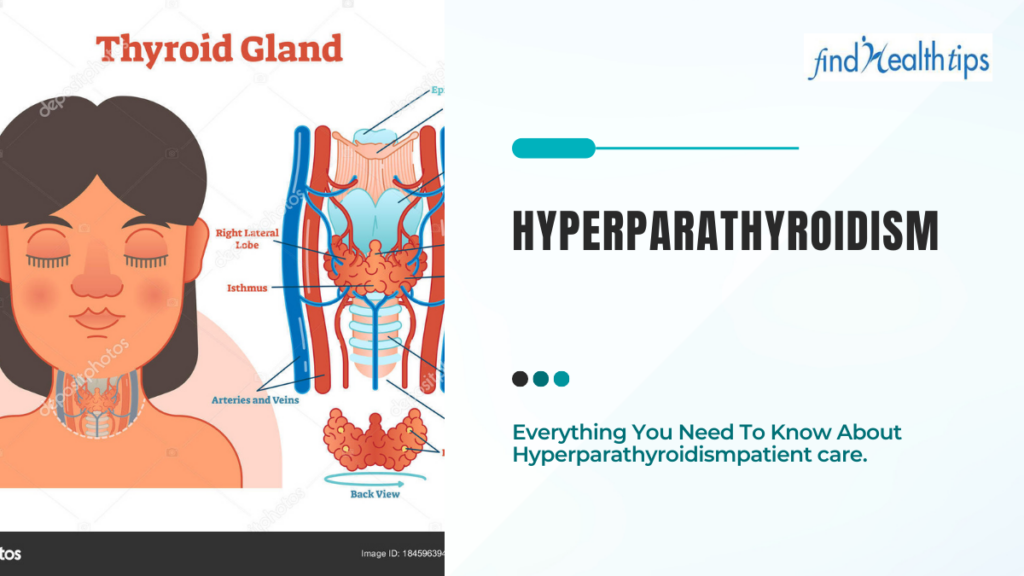 Hyperparathyroidism - vector image representing condition in thyroid gland