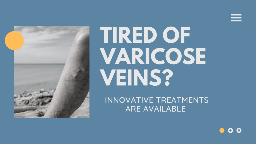 Tired of Varicose Veins? Here are the Innovative Treatments Available to Treat Them
