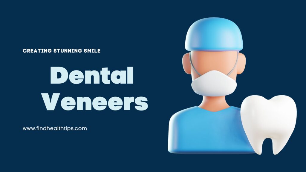 dental veneers