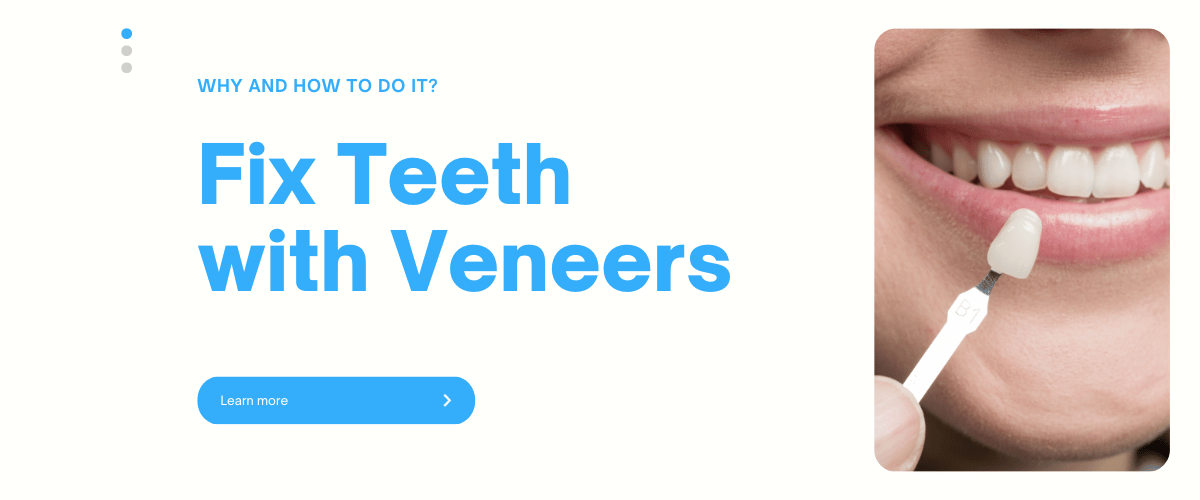 Fix Teeth With Veneers: Why Do It & How To Do It Right